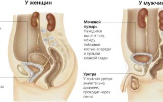 Как выявить Цистит у человека