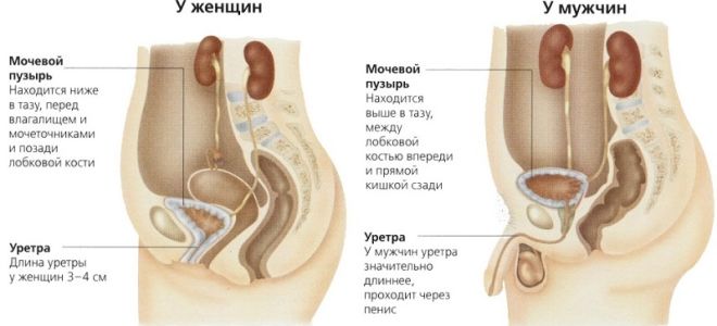 Как выявить Цистит у человека